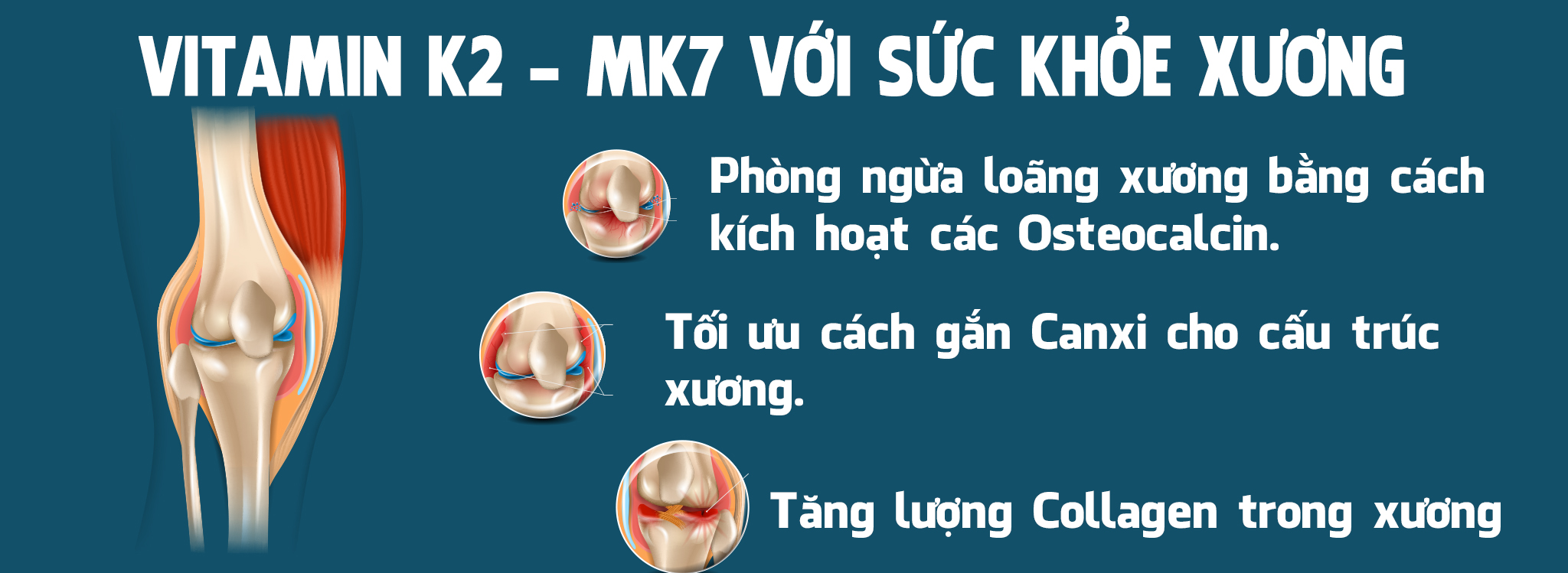 Vitamin K2 - MK 7 la gi - wheyshop