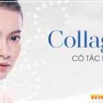 Collagen luôn được chị em phụ nữ truyền tai nhau về công dụng của việc giữ gìn sắc đẹp và chăm sóc sức khỏe đặc biệt. Biết được collagen có tác dụng gì sẽ...